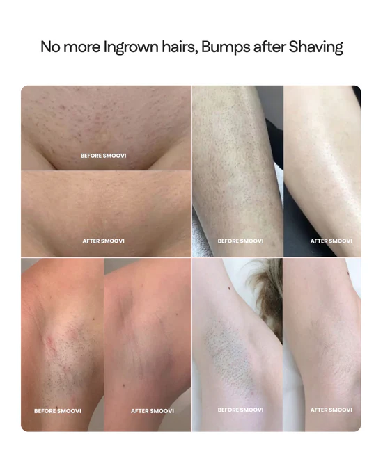 Female - Dual Head Bikini Shaver